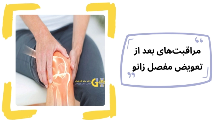 مراقبتهای بعد از تعویض مفصل زانو