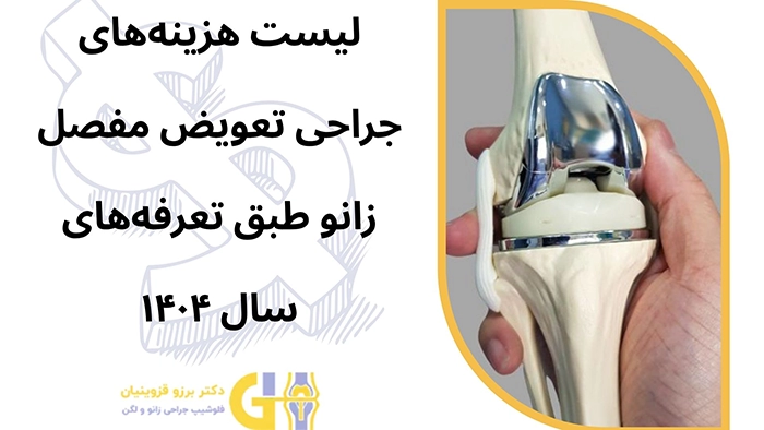 هزینه جراحی تعویض مفصل زانو