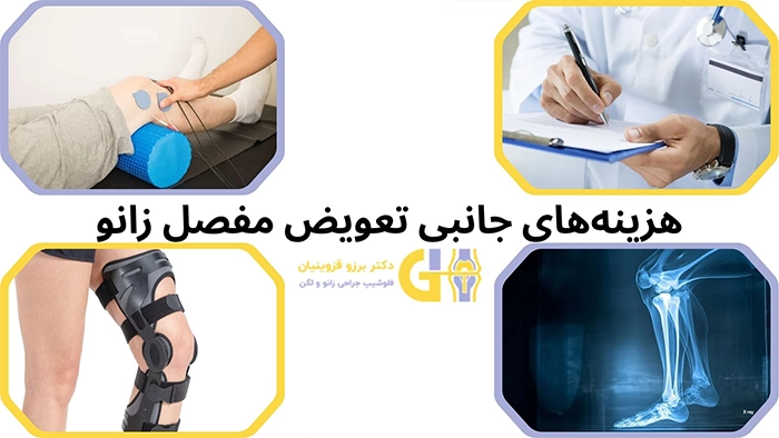 هزینه‌های جانبی تعویض مفصل زانو