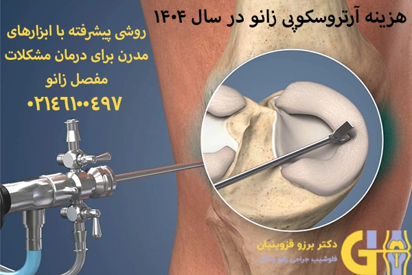 هزینه آرتروسکوپی زانو