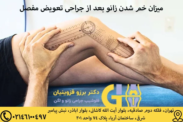 میزان خم شدن زانو بعد از جراحی تعویض مفصل