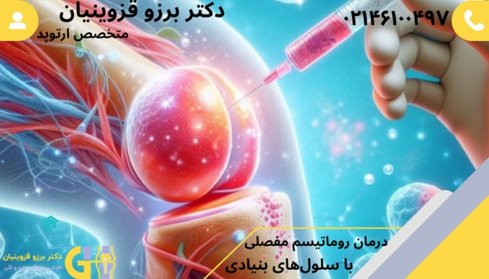 درمان روماتیسم مفصلی با سلول‌های بنیادی