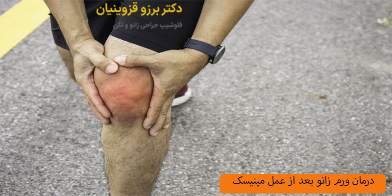 درمان ورم زانو بعد از عمل مینیسک