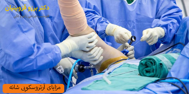 مزایای-آرتروسکوپی-شانه