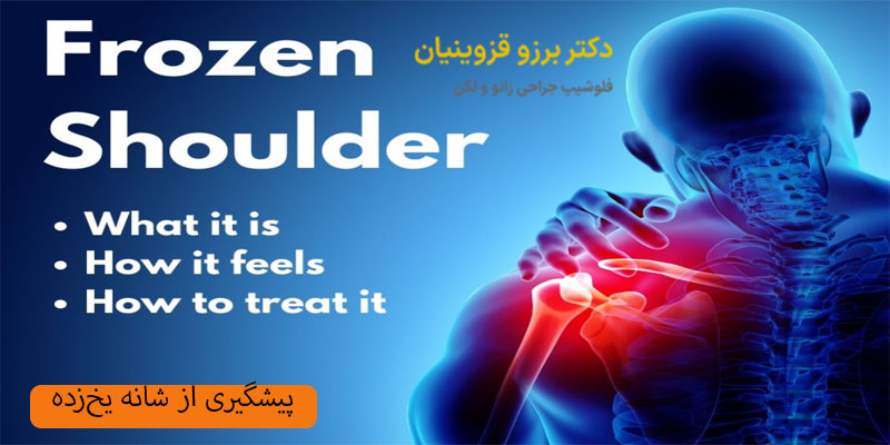 پیشگیری-از-شانه-یخ‌زده