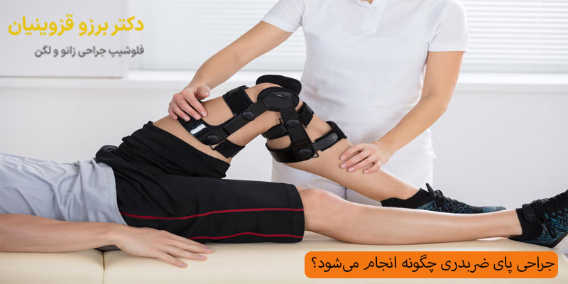 جراحی-پای-ضربدری-چگونه-انجام-می‌شود؟
