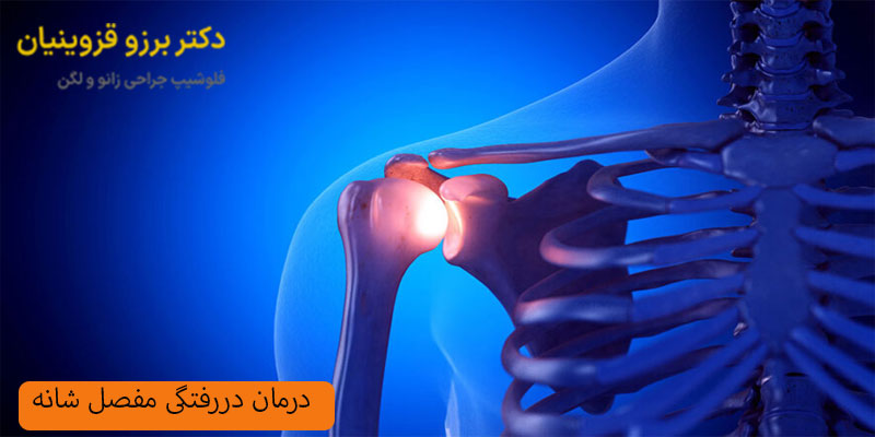 درمان دررفتگی مفصل شانه