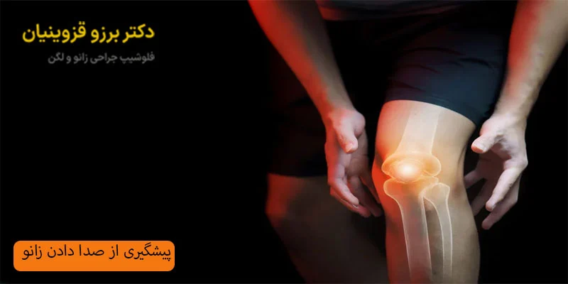 پیشگیری-از-صدا-دادن-زانو