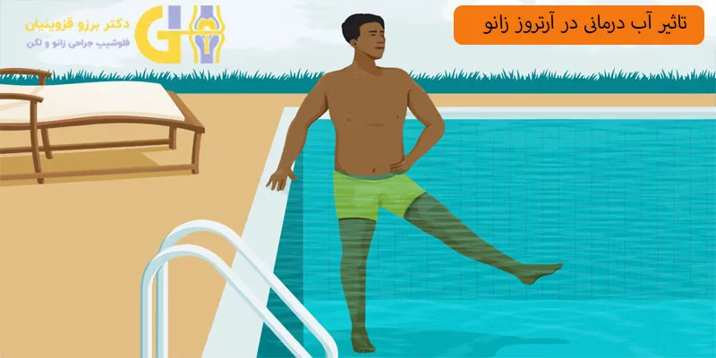 آب-درمانی-در-آرتروز-زانو