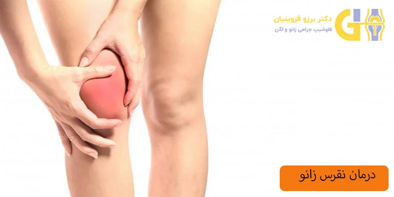 درمان-نقرس-زانو