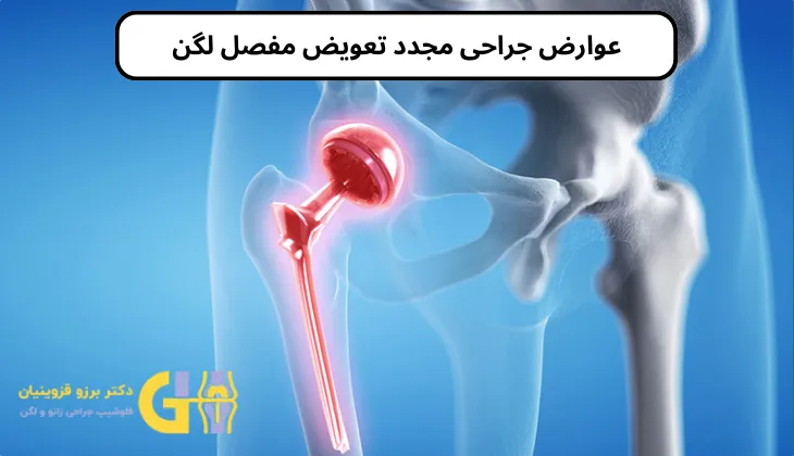 عوارض جراحی مجدد تعویض مفصل لگن