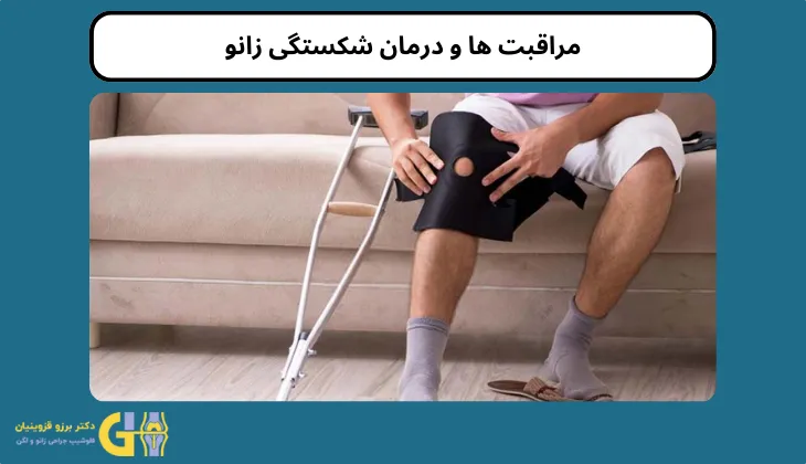 مراقبت ها و درمان شکستگی زانو