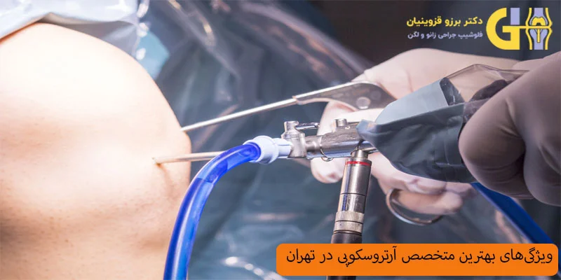ویژگی-های-متخصص-آرتروسکوپی