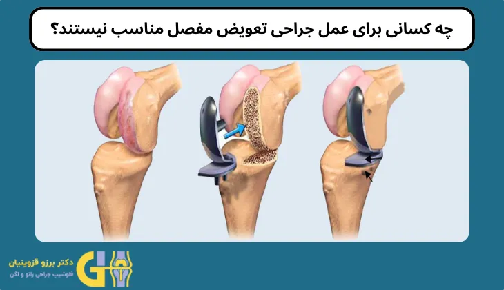 چه کسانی برای عمل جراحی تعویض مفصل مناسب نیستند؟