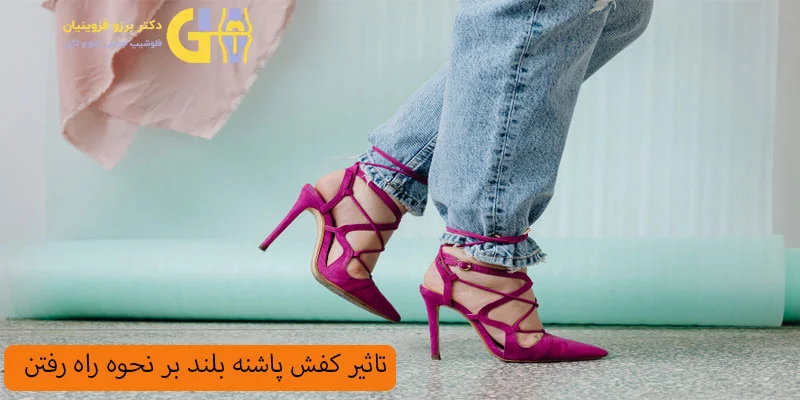 تاثیر-کفش-پاشنه-بلند-بر-نحوه-راه-رفتن