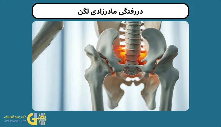 دررفتگی مادرزادی لگن