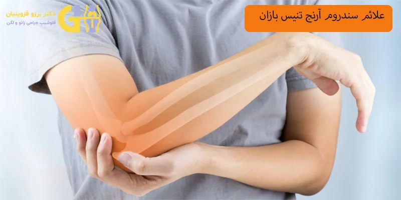 علائم-سندورم-تنیس-بازان