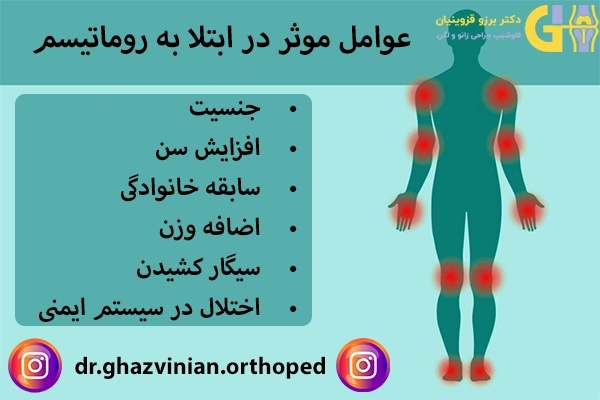 عوامل موثر در ابتلا به روماتیسم