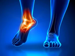 پیچ خوردن مچ پا